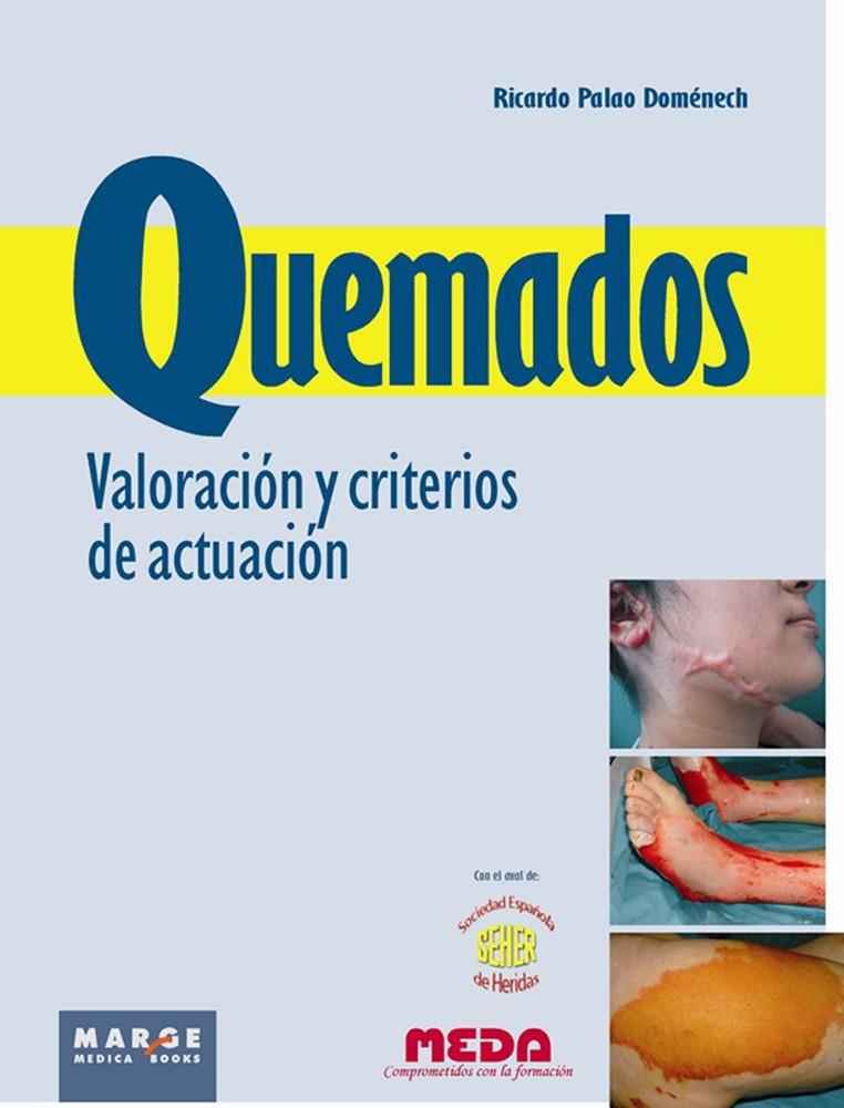 QUEMADOS. VALORACION Y CRITERIO | 9788415340140 | PALAO DOMENECH, RICARDO